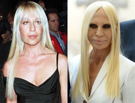 donatella versace chirurgie ratée|donatella versace plastic surgery.